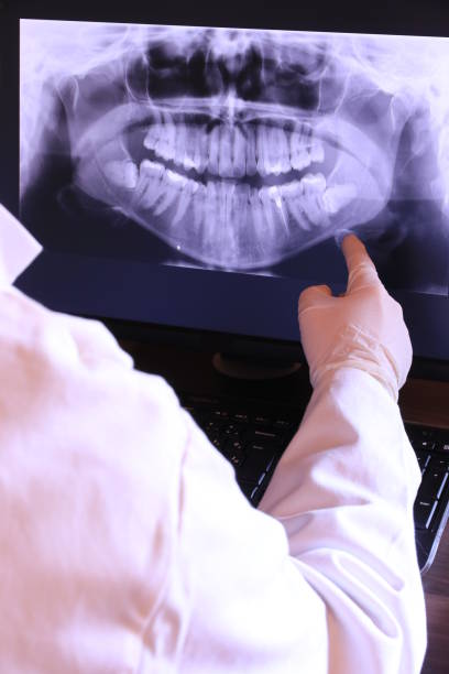 Emergency Dental Filling Replacement in WI