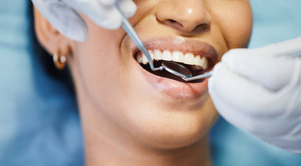 Best Broken Tooth Emergency  in Milton, WI